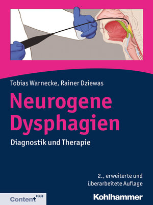 cover image of Neurogene Dysphagien